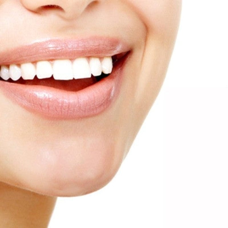 Remedy Health Health Professional Remedy Health Professional Teeth Whitening Home Kit TWK001 (6955042406489)